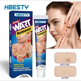 تخلص من الثآليل بسرعة وفعالية مع كريم HBESTY