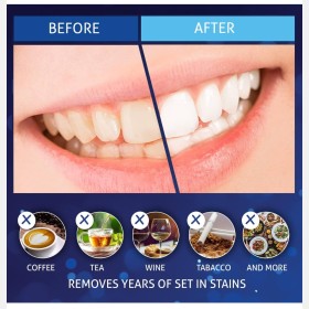 شرائط تبييض الأسنان Magic Brite 5D