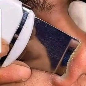 جهاز  التراسونيك العالمي لتنضيف البشرة 5 في 1