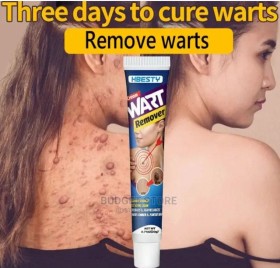 تخلص من الثآليل بسرعة وفعالية مع كريم HBESTY